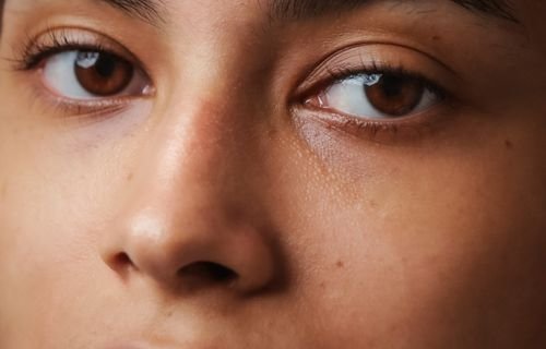 How to treat pigmentation effectively