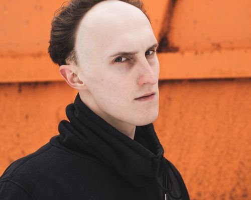 Day Of My Hair Transplant