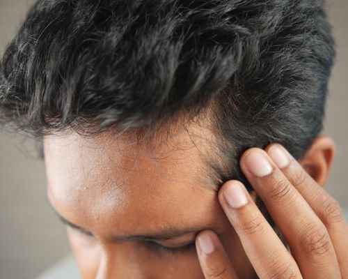 Patient sharing their hair fall journey
