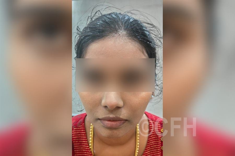CFH skin treatment patient result