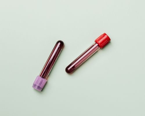 GFC Treatment